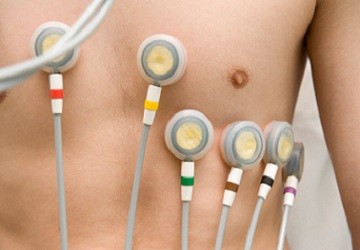 Belastungs EKG